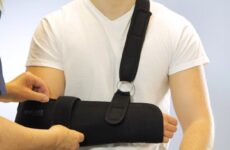 Arm Sling – A Complete Guide