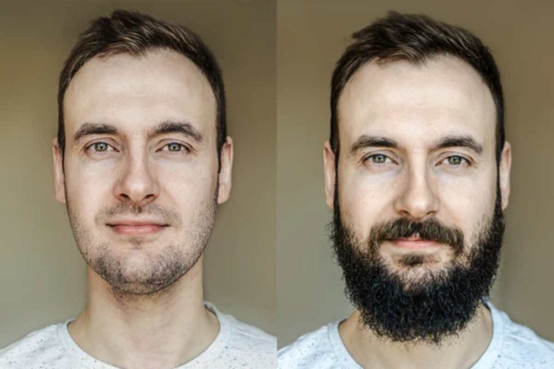 Beard Styles for Patchy Beard_ Mastering the Art of Grooming Uneven Growth